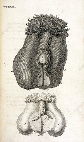 lithograph of intersex reproductive organs in humans show the relation between a male and female reproductive organ. in relation to sexuality biology and evolution